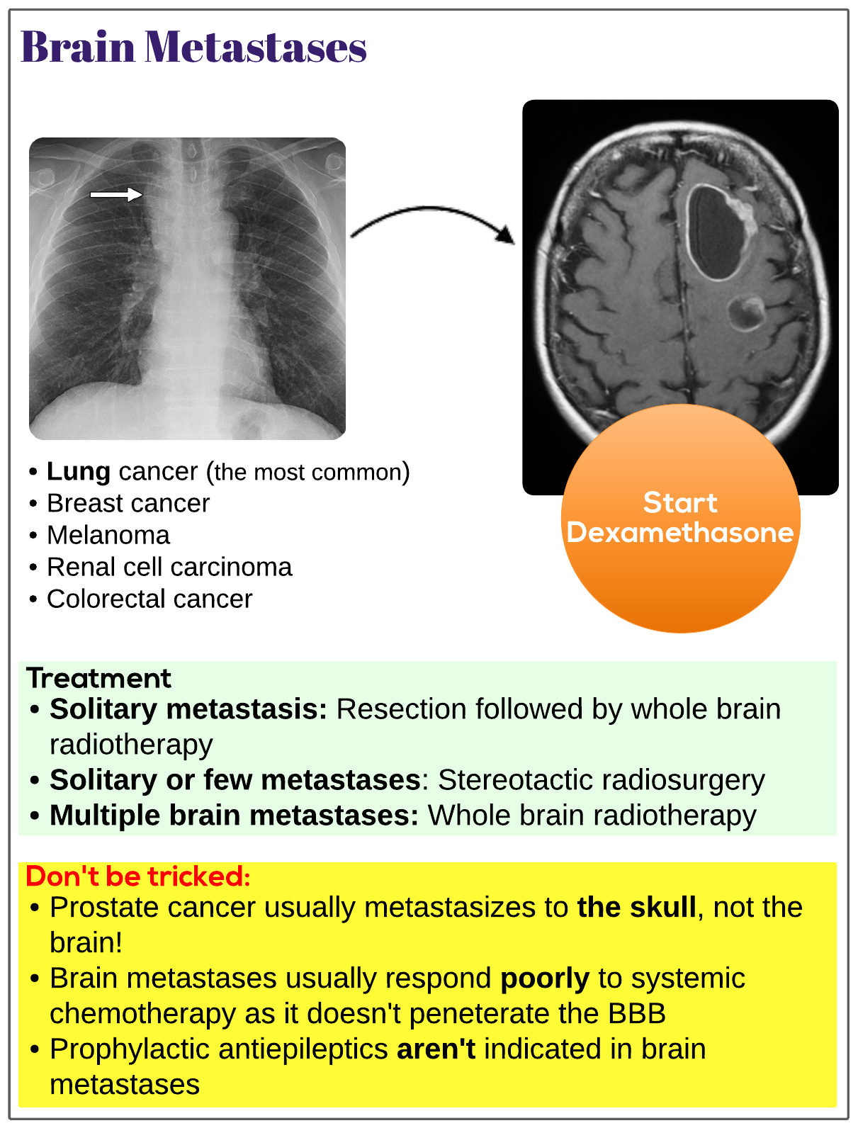 presentation for brain metastasis
